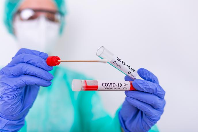 Koronavirus, Korona. Covid. Covid-19. Cepjenje. Test. Testiranje. Maske. | Z novim koronavirusom se je od začetka epidemije okužilo več žensk kot moških. | Foto Shutterstock