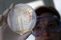 Marušič: V Sloveniji ni izrednih razmer zaradi bakterije E.coli