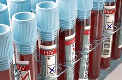 Rekordno število okuženih z virusom HIV ima dostop do terapije