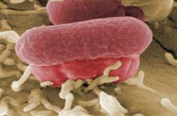 V Nemčiji novi smrtni žrtvi zaradi bakterije Ehec