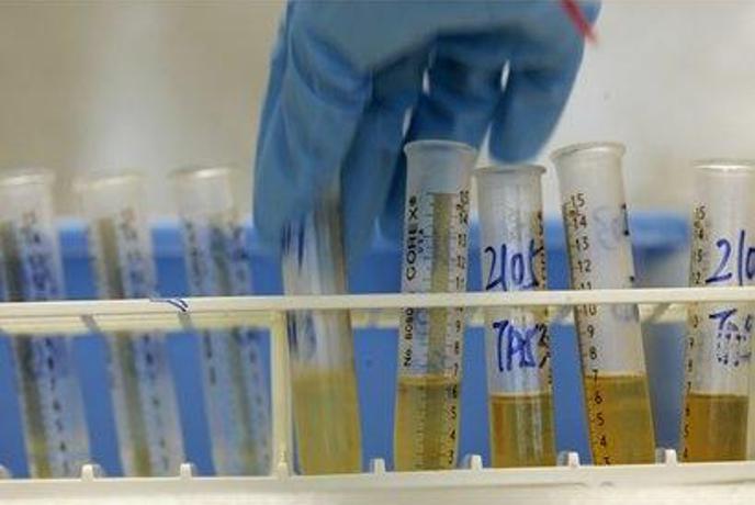V Grčiji spet doping