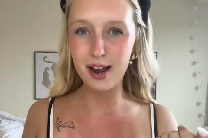 viralni trend, izpuščaj | V viralnih videoposnetkih nekateri vplivneži natančno prikazujejo, kaj je treba storiti, da se na koži pojavijo izpuščaji. | Foto posnetek zaslona/TikTok