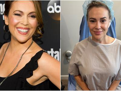 Igralka Alyssa Milano si je dala odstraniti vsadke iz prsi: Zdaj sem svobodna