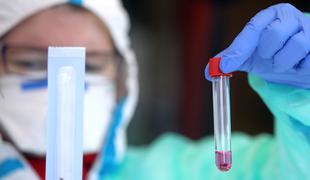 Nemški znanstveniki: Krvna skupina lahko vpliva na potek bolezni covid-19