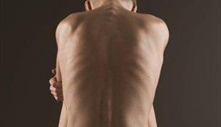 Thinspiration: nevarno spodbujanje k hujšanju in anoreksiji
