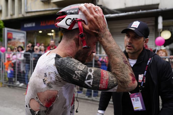 Adam Yates | Adam Yates je po množičnem padcu v drugi etapi Gira v cilj prišel krvav in z velikim zaostankom. | Foto Profimedia