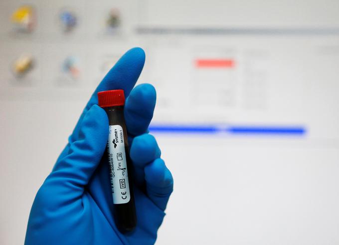 Doping test | Foto: Reuters
