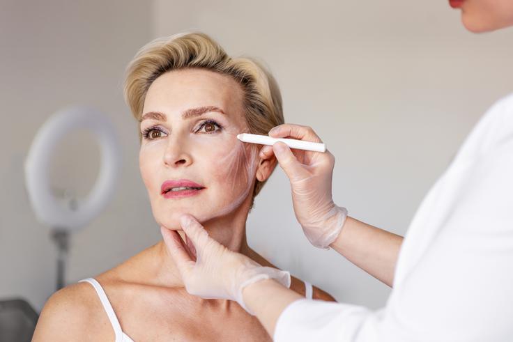 facelift, dvig obraza | Foto: Shutterstock