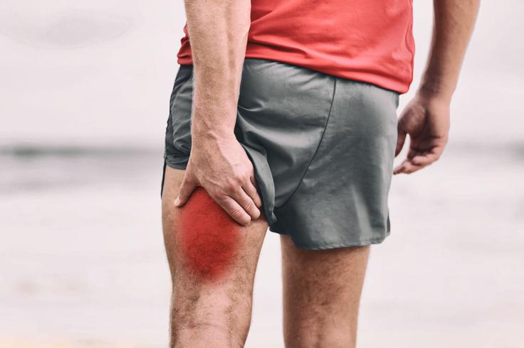Natrganina mišice_hamstringi | Foto: Medicofit
