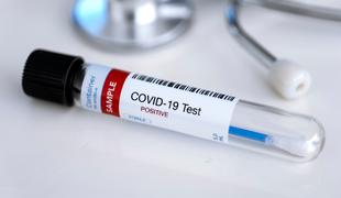 Covid-19: tolikokrat se je okužila največkrat okužena oseba v Sloveniji