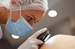 Vaša koža je dragocena. Redno jo pregledujte.