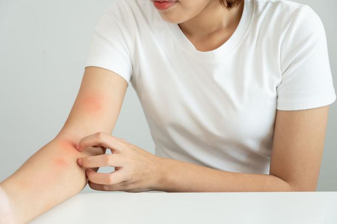 Medicofit, lupus | Foto Medicofit