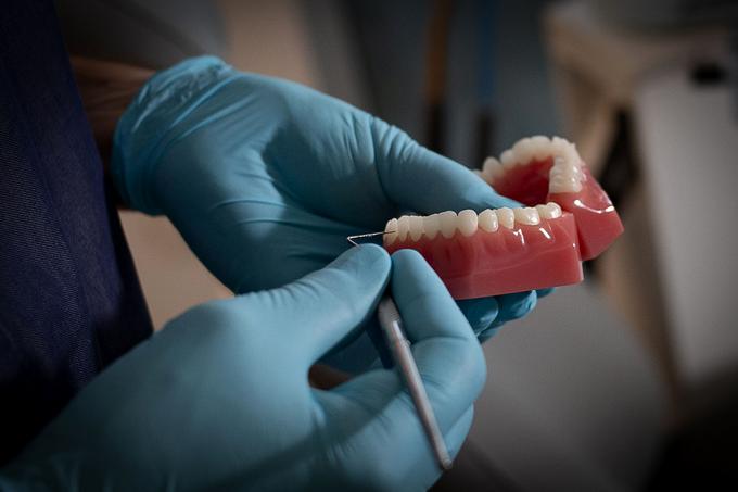 Trde zobne obloge najpogosteje nastajajo na težje dostopnih mestih, ki zaradi tega ostajajo neočiščena. To so predvsem predeli med zobmi in ob dlesni. | Foto: Ana Kovač