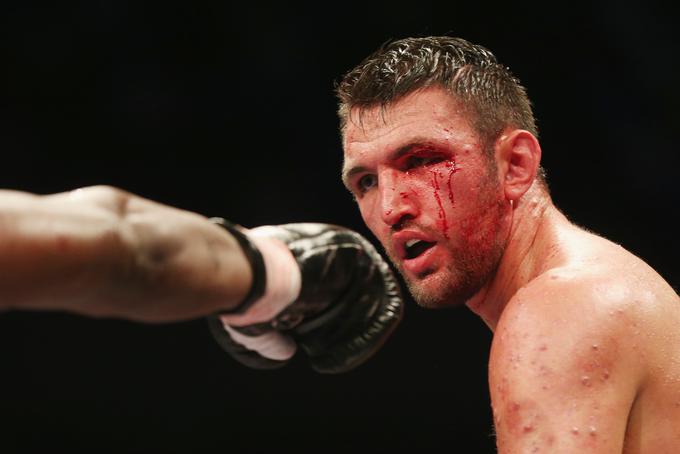 Komaj 22-letni Hughie Fury ima za sabo že 20 profesionalnih borb in prav vse je dobil, 6. maja se bo v Aucklandu udaril za svetovni naslov. | Foto: Getty Images