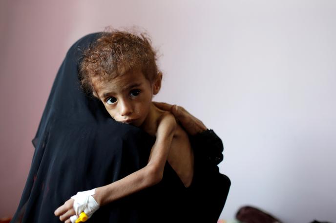 Jemen | Septembra so ocenili, da lakota grozi 11 milijonom ljudi, vendar pa so se razmere v zadnjem času še poslabšale, tako da zadnja ocena znaša 14 milijonov ljudi. | Foto Reuters