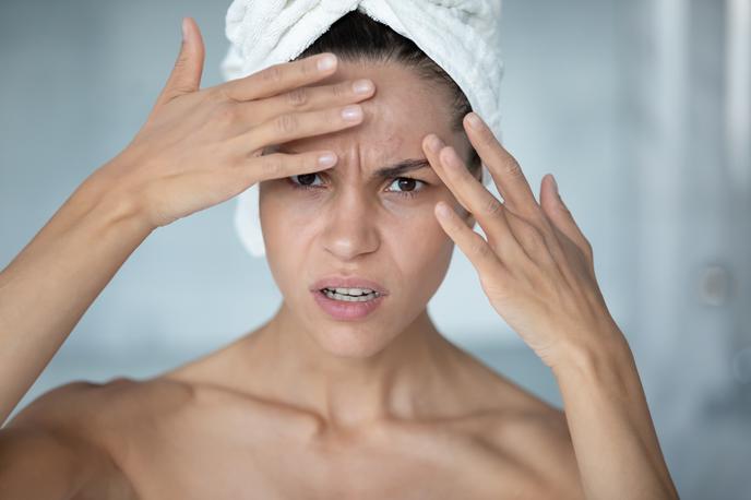 botoks, lepotni poseg | Foto Shutterstock