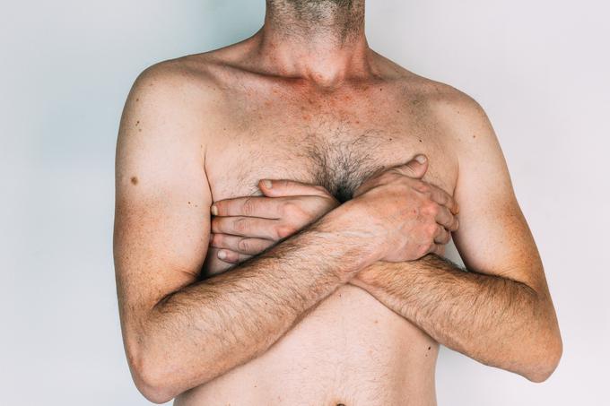 Zaradi ginekomastije se za korekcijo prsi odloča tudi vse več moških. | Foto: Getty Images