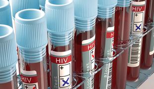 Rekordno število okuženih z virusom HIV ima dostop do terapije