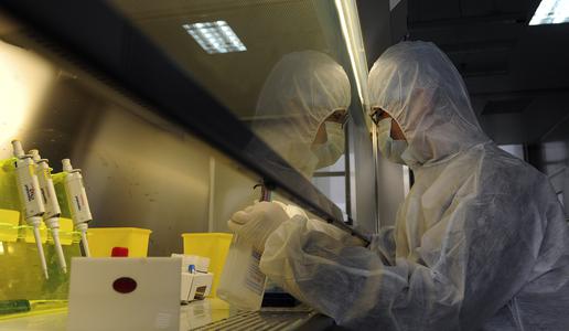 V ZDA poročajo o prvem primeru ptičje gripe H5N5 pri človeku