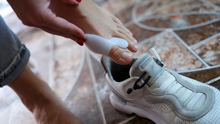 Medicofit, Hallux valgus | Foto: Medicofit