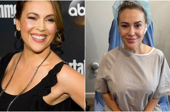 Igralka Alyssa Milano si je dala odstraniti vsadke iz prsi: Zdaj sem svobodna