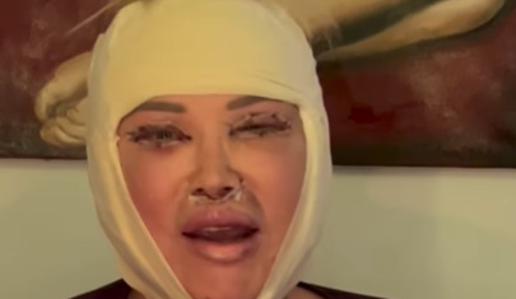 Salome je pokazala rezultat lepotne operacije
