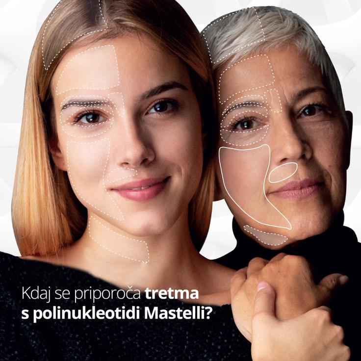 est-slo-7_1200 | Foto: PONTUS PHARMA D.O.O.