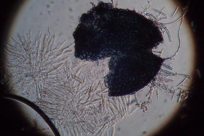 gliva fusarium graminearum | Gliva fusarium graminearum povzroča bolezni več vrst žit, škodo zaradi bolezni, ki jih povzroča, ocenjujejo na več milijard evrov. | Foto CIMMYT