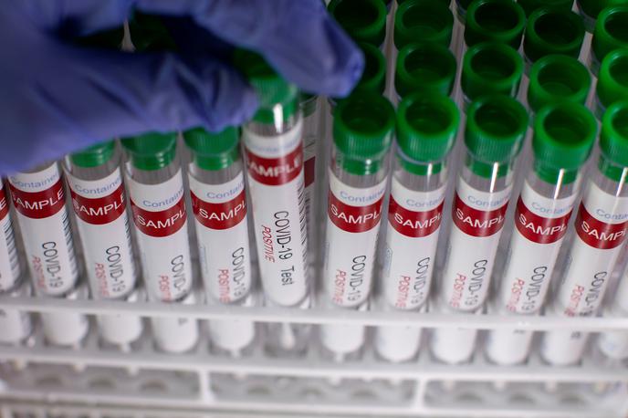 covid | Število novih okužb s koronavirusom je spet visoko.  | Foto Reuters