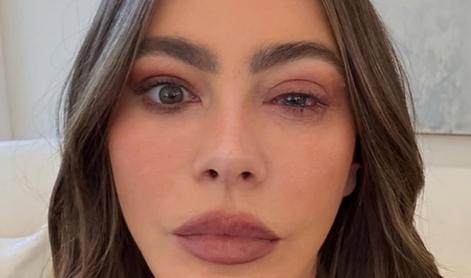 Sofia Vergara zaradi hude alergijske reakcije pristala na urgenci #video