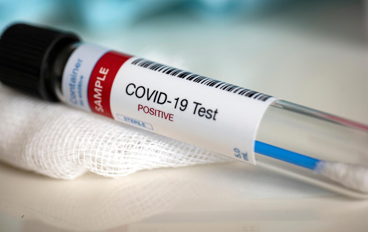 Koronavirus, Korona. Covid. Covid-19. Cepjenje. Test. Testiranje. Maske. | V torek so potrdili 1.821 okužb s koronavirusom. | Foto Shutterstock