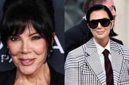 Je lepotni poseg na obrazu Kris Jenner res že popustil?
