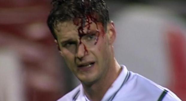 Njegova glava je krvavela, Slovenija pa žarela od ponosa