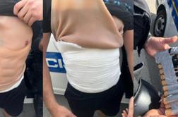 Pred derbijem množični pretep, pa veliko dela za varnostnike na Poljudu #video