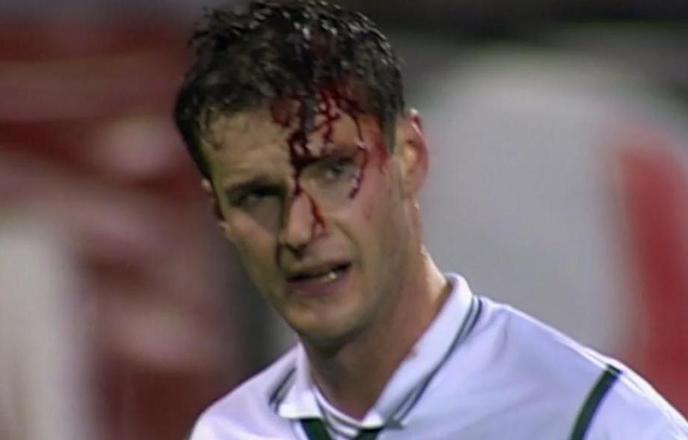 Njegova glava je krvavela, Slovenija pa žarela od ponosa