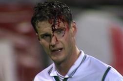 Kruto, a resnično. Vsakič, ko je udaril žogo, ga je oblila kri.