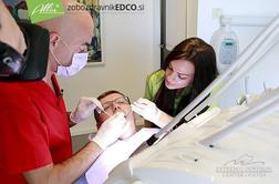 Najpogostejša in najbolj zanimiva vprašanja o zobeh! Vas preseneča?