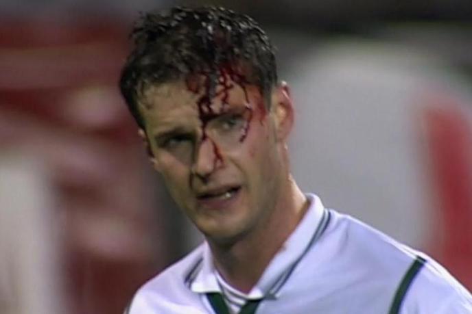 Njegova glava je krvavela, Slovenija pa žarela od ponosa