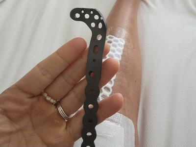 Federica Brignone uspešno prestala operacijo