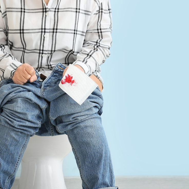 Detralex, hemoroidi | Foto: arhiv naročnika