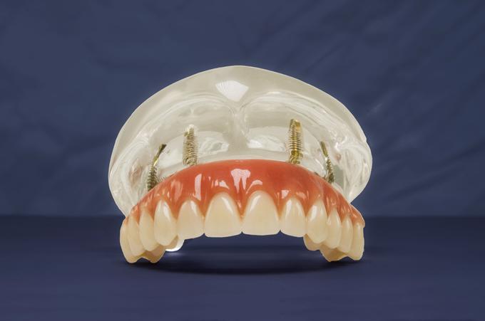 Ortoimplant, SMT dent | Foto: ORTOIMPLANT DENTAL SPA
